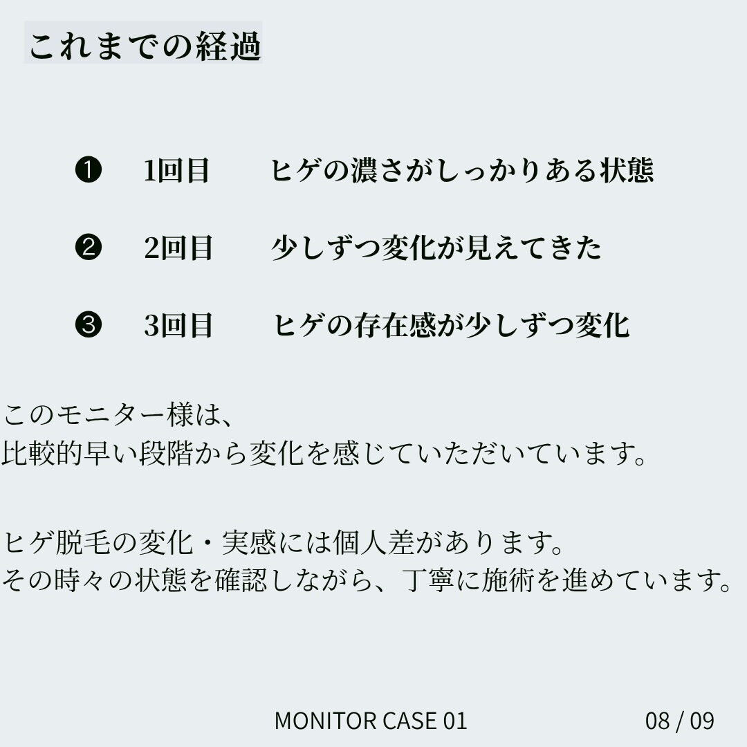 【ヒゲ脱毛｜モニター様の経過記録】