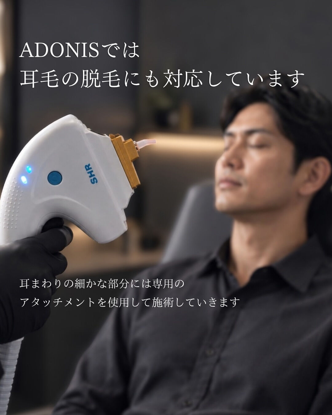 耳毛、脱毛できます